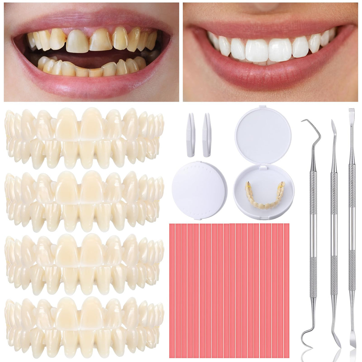 35 Pcs Dentures Repair Kit with Tools W896